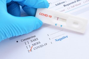 SARS-CoV-2 (Covid-19): Diagnosis by IgG/IgM Rapid Test Kyvobio Belgium